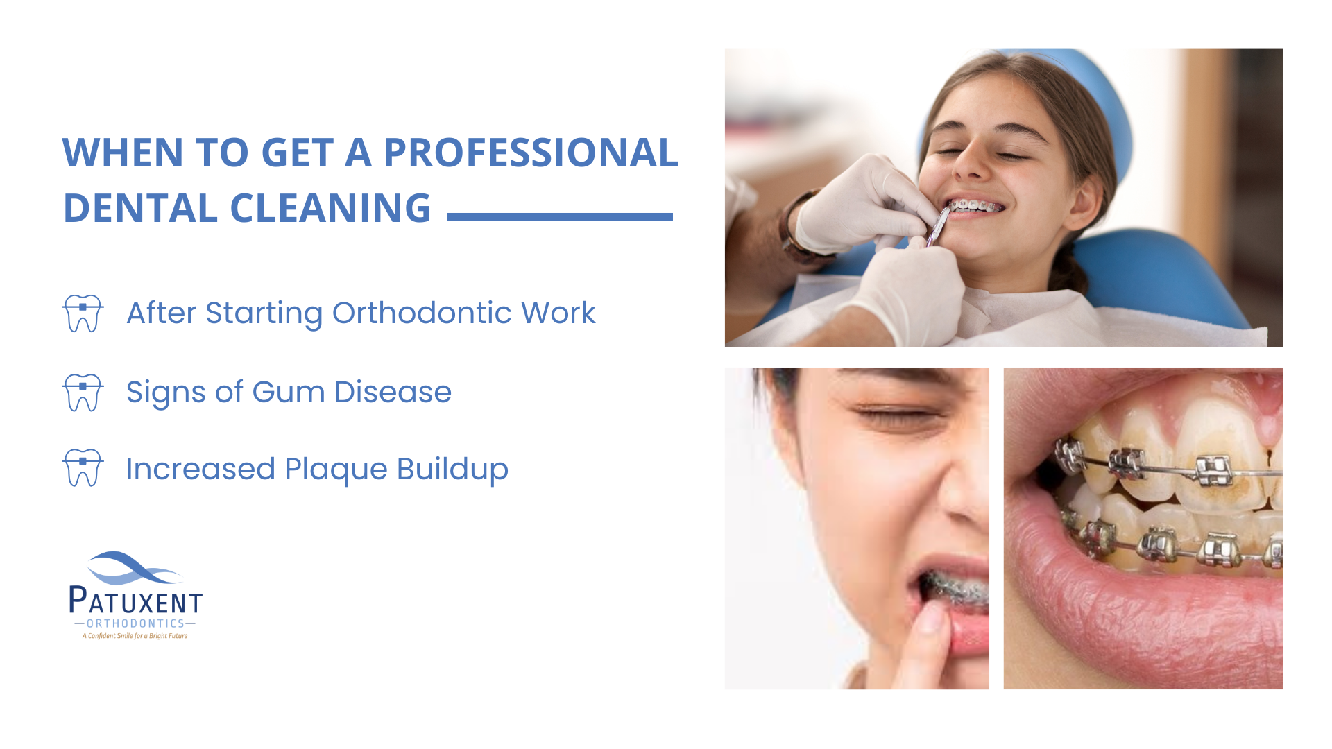 When to Get a Professional Dental Cleaning