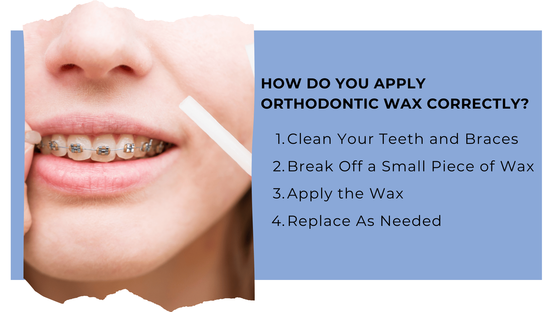 how to apply orthodontic wax correctly