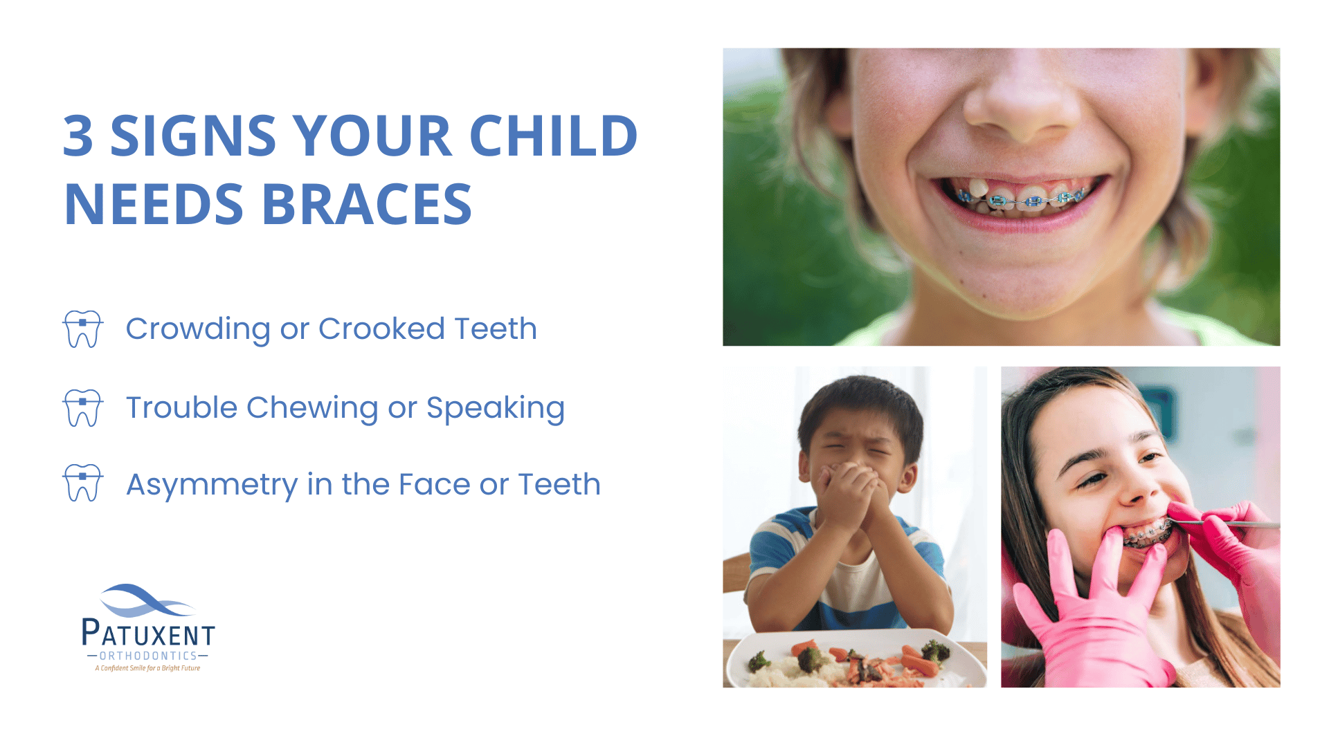 This is an infographic depicting the 3 signs your child needs braces