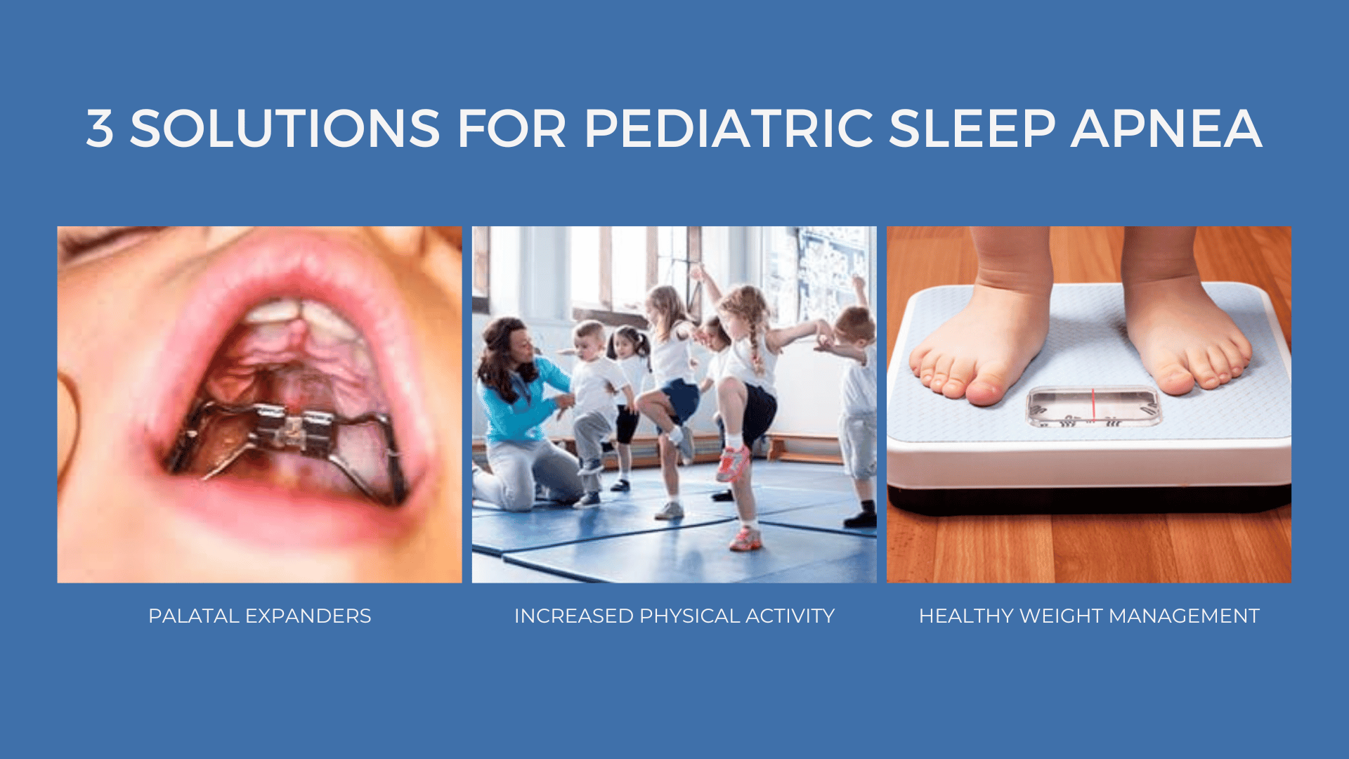 3 solutions for pediatric sleep apnea