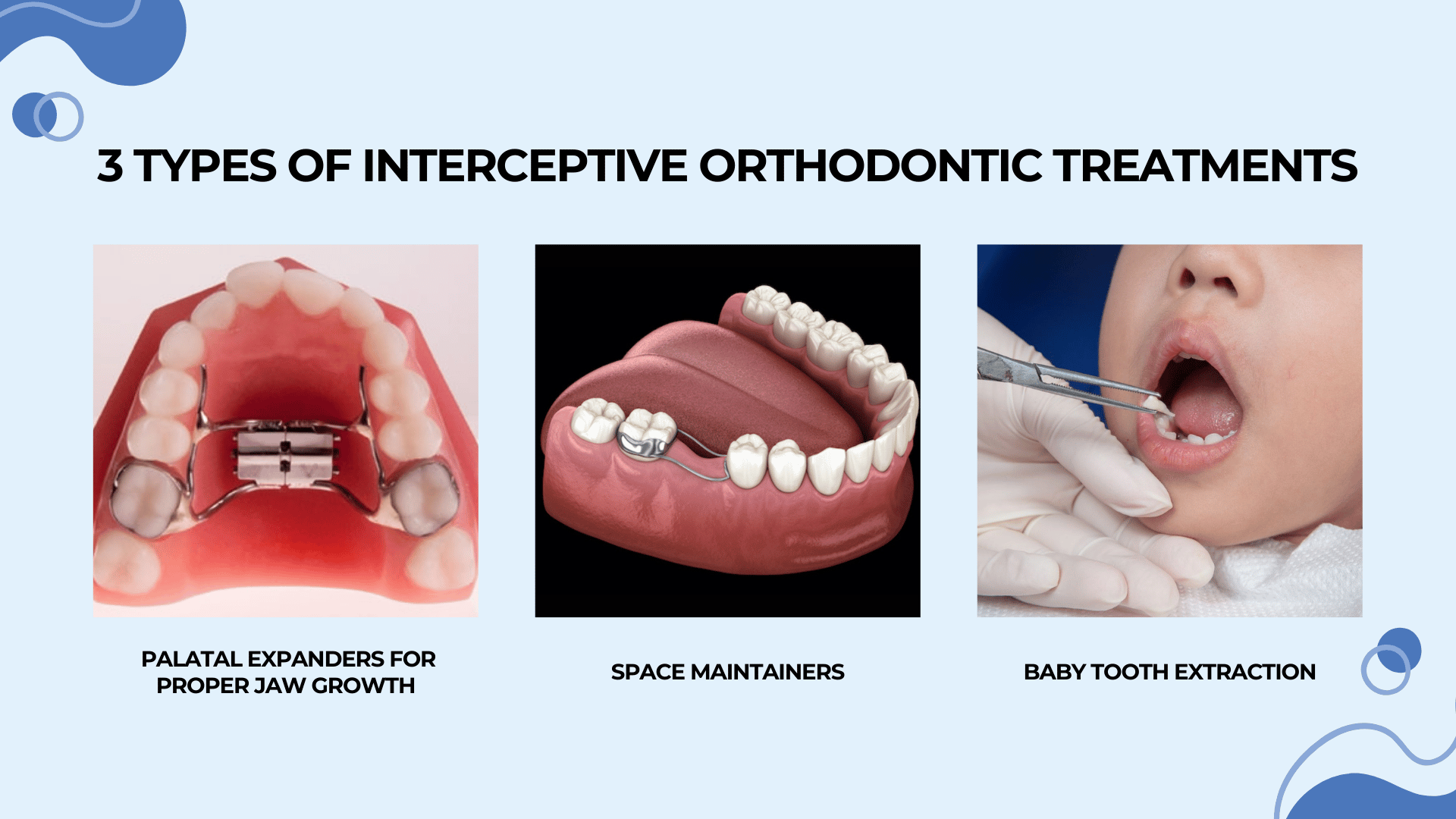 This is an infographic detailing the 3 types of interceptive orthodontic treatments