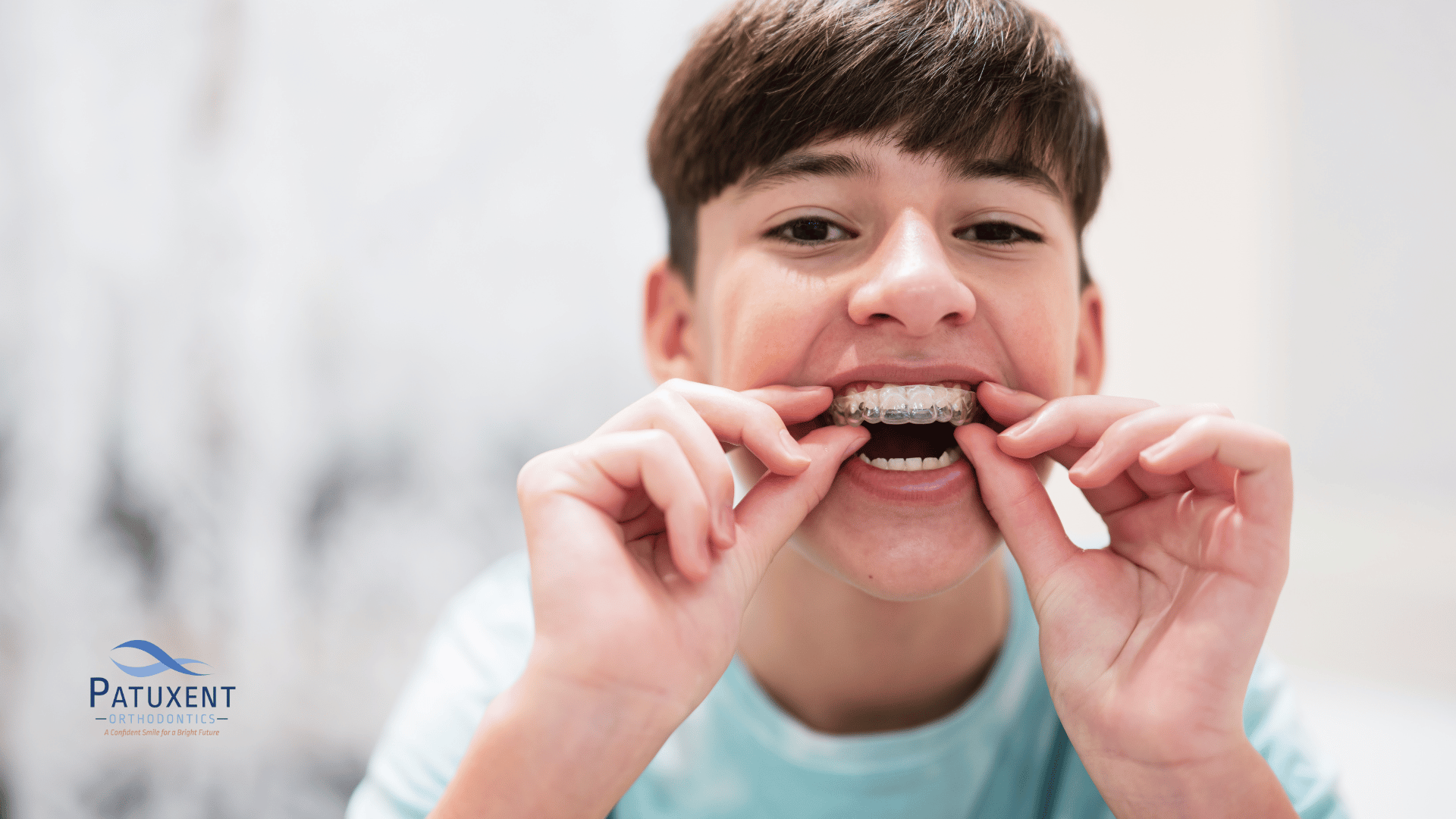 This is an image of a teenage boy putting on a clear aligner