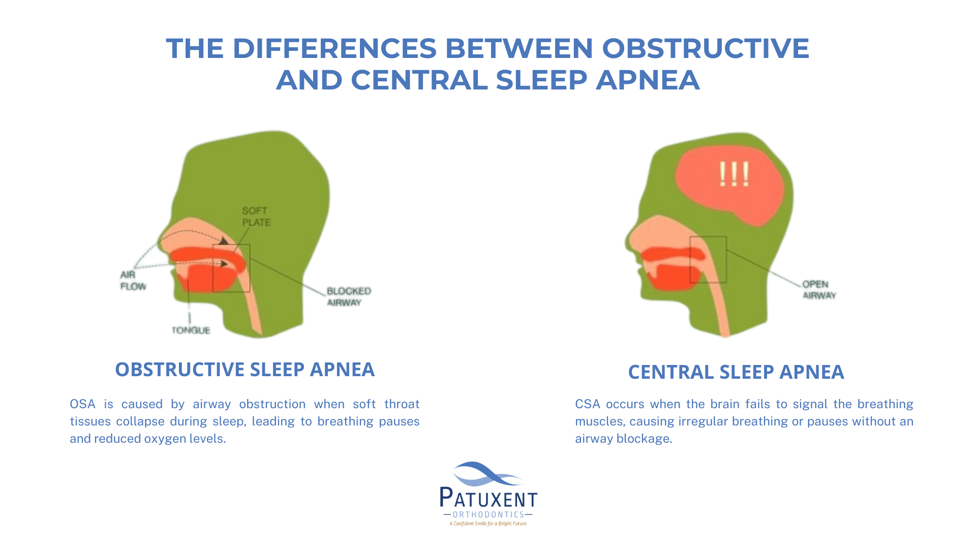 the differences between obstructive and central sleep apnea